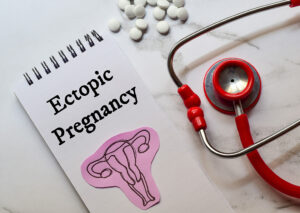 宮外孕是什麼？拆解宮外孕成因、5大症狀、診斷及治療方法